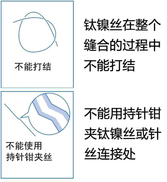 【兆恒機(jī)械】鈦鎳記憶合金組織吻合器使用注意事項(xiàng)